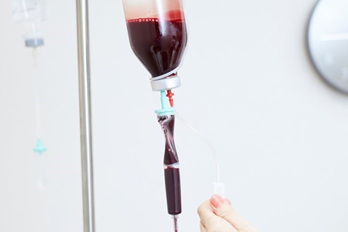 血液クレンジング（オゾン療法）